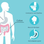 How To Improve Gut Health
